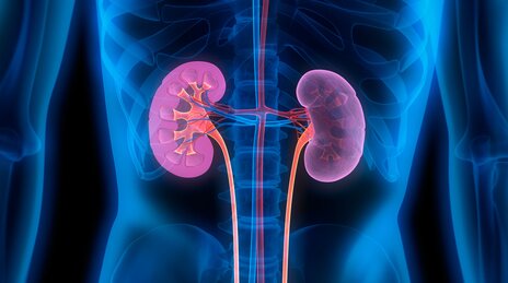 Daño a los Riñones Silencioso, que se Asocia Principalmente con la Diabetes Daño a los Riñones Silencioso, que se Asocia Principalmente con la Diabetes