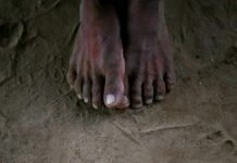 Arrestan a Hombre en la India ¡por el Olor de sus Pies!