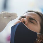 Personas con Covid-19 Grave Tienen Menor Respuesta Antiviral en la Nasofaringe