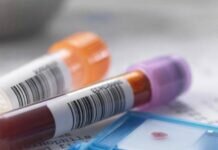 Covid-19 Aleja a la ONU de su Meta de Acabar con el Sida en 2030