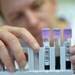 Disminuir Niveles de Colesterol “Malo” Evita Desarrollo de Aterosclerosis